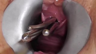 ���લાપ્રેમી FreyjaAnalslut: સળિયા માં Freyja માતાનો pisshole